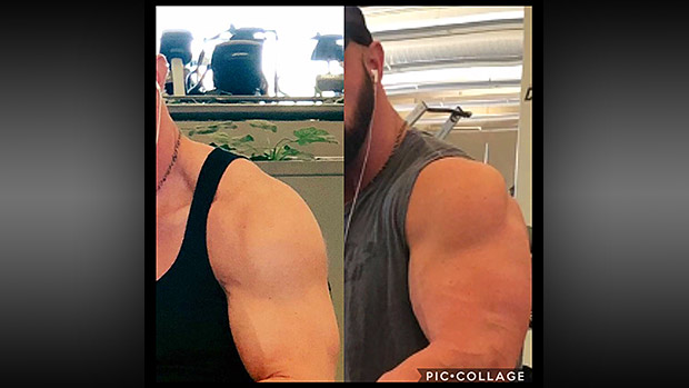 Before and After Biceps