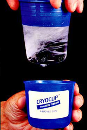 CryoCup
