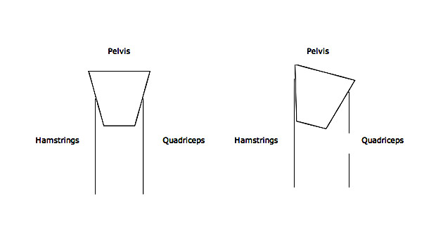 Neutral Alignment vs. Anterior Pelvic Tilt